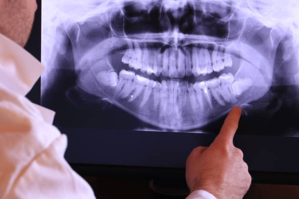Best Emergency Tooth Extraction in Budd Lake, NJ